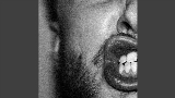 Miniature de la vidéo Diastema