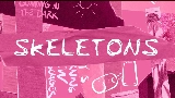 Miniature de la vidéo Skeletons
